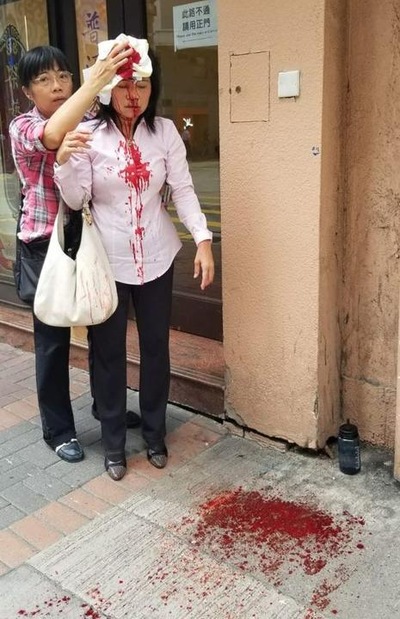 Innocent Falun Gong Woman Savagely  Attacked on the Streets of Hong Kong by CCP Thugs